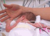 L’accouchement prématuré – causes et conséquences Slider Bébé prématuré