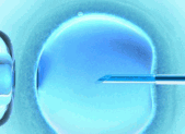 La fécondation in vitro (FIV) Slider FIV