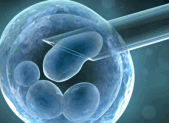 L’insémination artificielle Slider Insemination artificielle