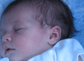 Otite bébé : symptômes et traitements Slider otite bébé