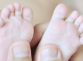 Syndrome pieds-mains-bouche Slider Pied main bouche