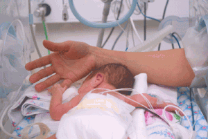 Bébé prématuré